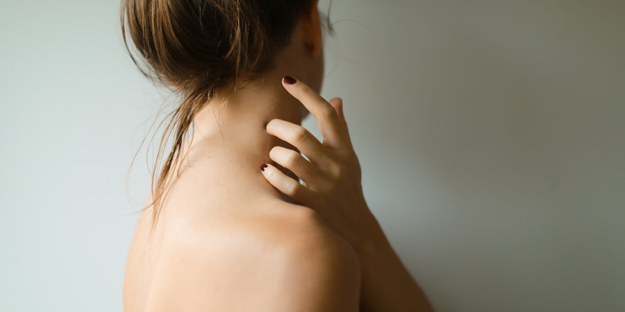 My Eczema Story: prevention vs cure